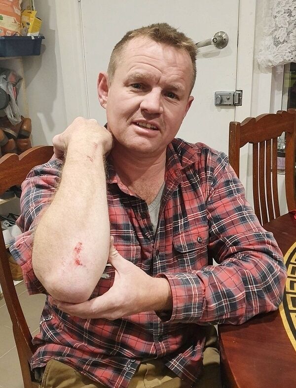 Shane Donaghey, who was injured when he assisted with capturing a terrorist in Australia. Photo: Joe Boland.