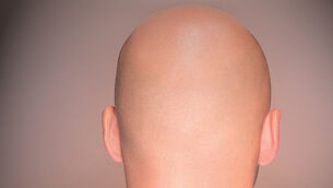 Hair today, still there tomorrow