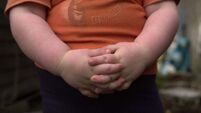 Formula predicts child’s risk of obesity 