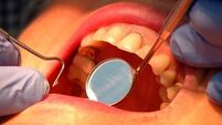 Free mouth tests in Cork and Dublin today