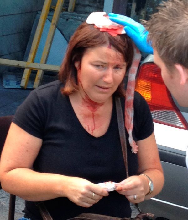 Woman left bloodied after mallet fell on her head