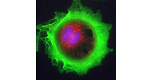 Cancer scientist to turn rivals green with envy in New York