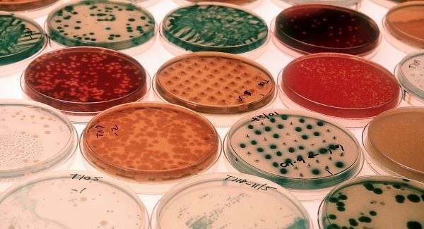 Scientists detect bacteria defence