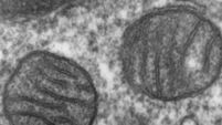 Don&rsquo;t waste second chance - A new antibiotic
