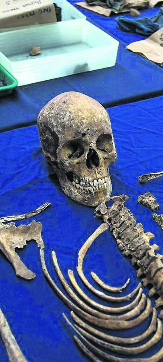 Skulls and remains in the laboratory of the Forensic Anthropology Foundation of Guatemala. Fredy Peccerelli and his staff have uncovered more than 10,000 bodies and want to bring the remains back to families who have been searching for their mothers, fathers, sons and daughters for decades.