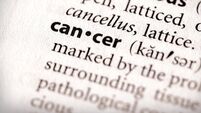 We need to consider lung cancer screening as early detection is vital