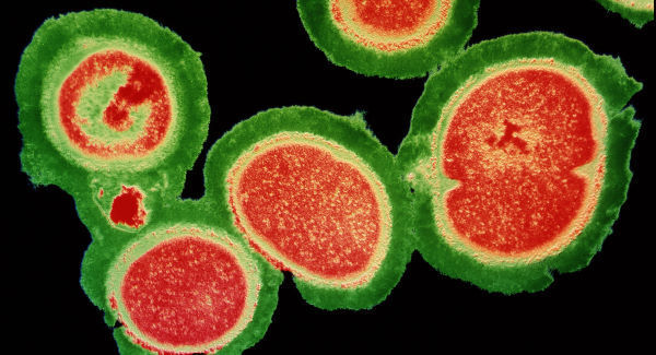 The greatest threat to humanity isn't terrorism, it's superbugs
