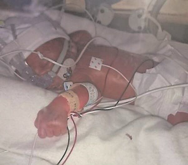 Jacob still in the Neonatal Intensive Care Unit (NICU) Jacob still in the Neonatal Intensive Care Unit (NICU)