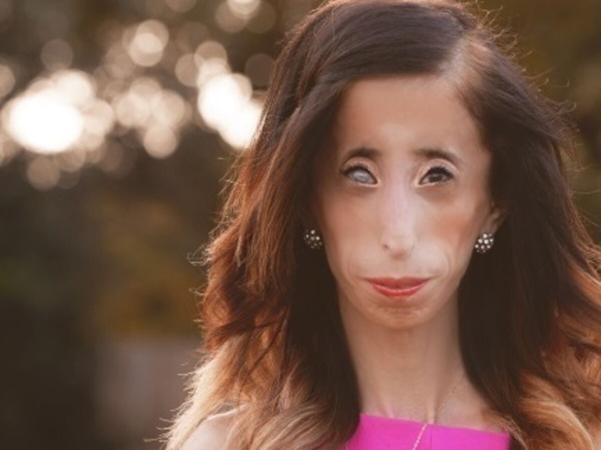 The Most Ugliest Girl In The World