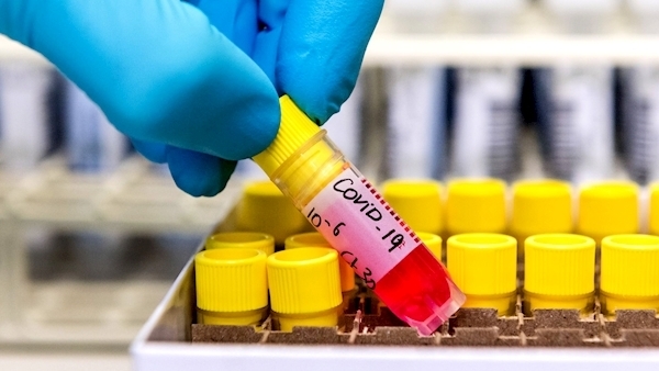 Priority Covid-19 testing to be considered for direct provision residents