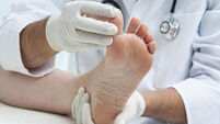 Natural Health: Every summer my athlete's foot returns. What can I do? 