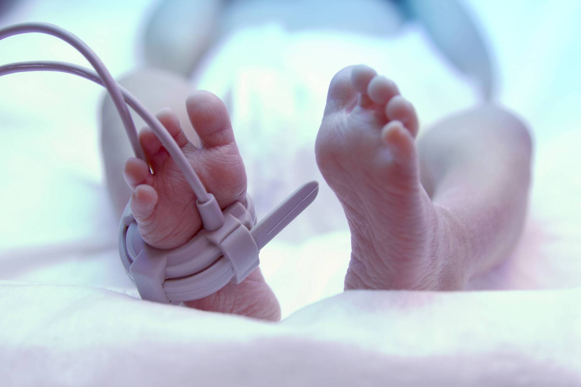 Study suggests fewer babies born  prematurely during lockdown