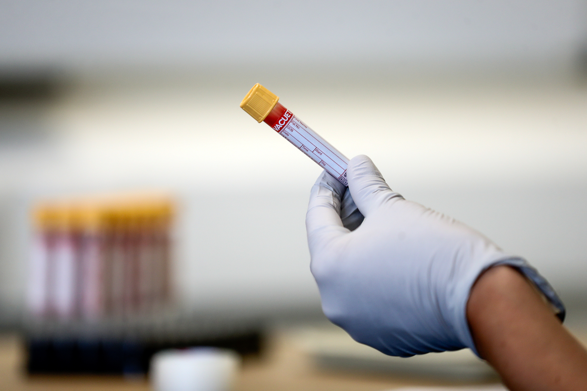 Livingston factory could help produce 60 million doses of coronavirus vaccine