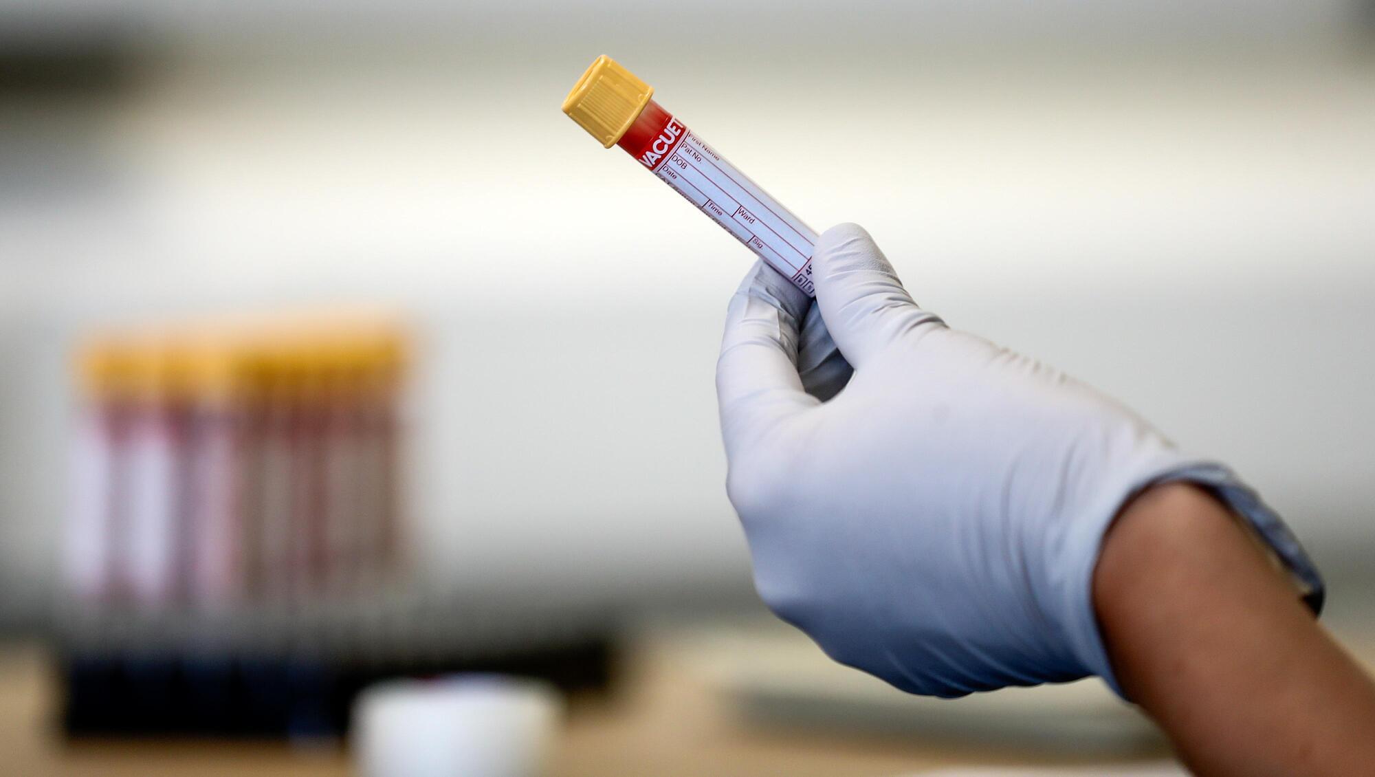 Ireland's Covid-19 approach 'probably not working' says health expert