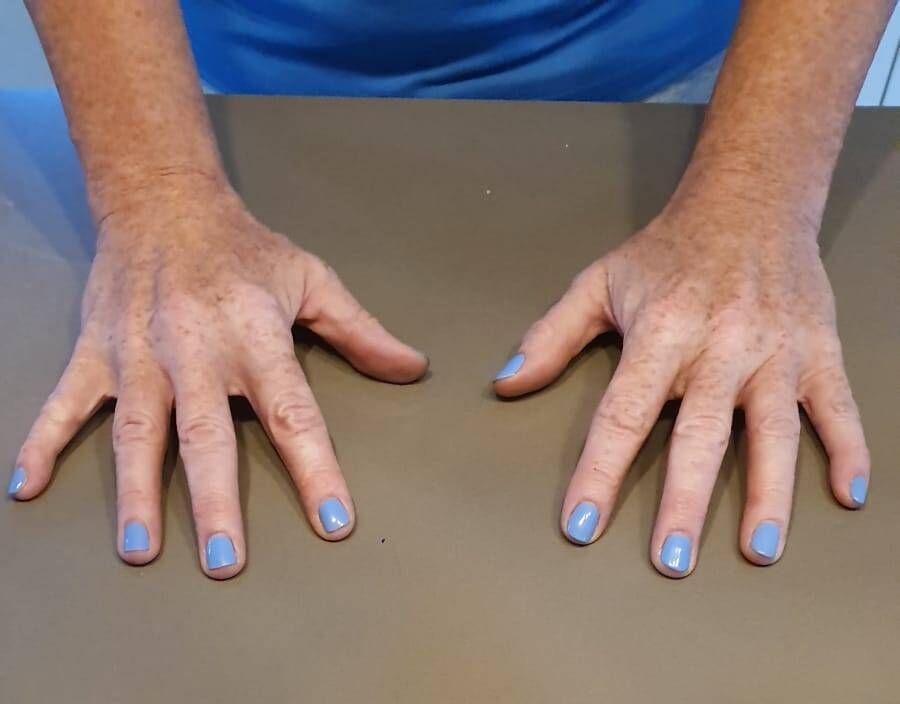 Linda Mellerick's Hurling Hands