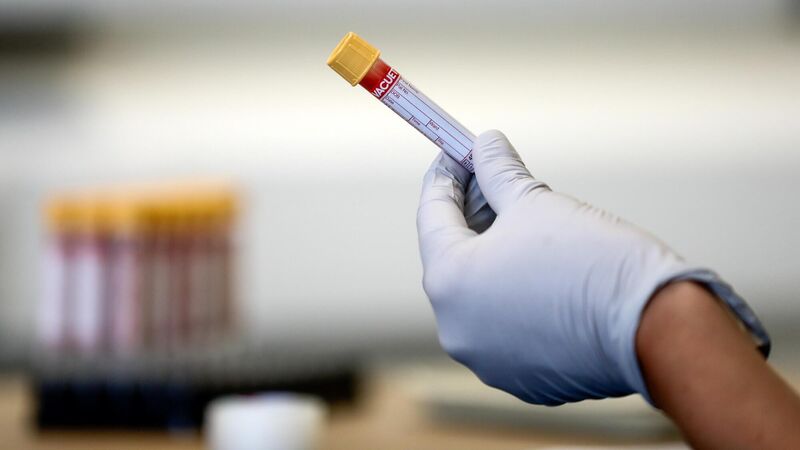 Steroids reduce risk of death in critically ill Covid-19 patients – study Steroids reduce risk of death in critically ill Covid-19 patients – study