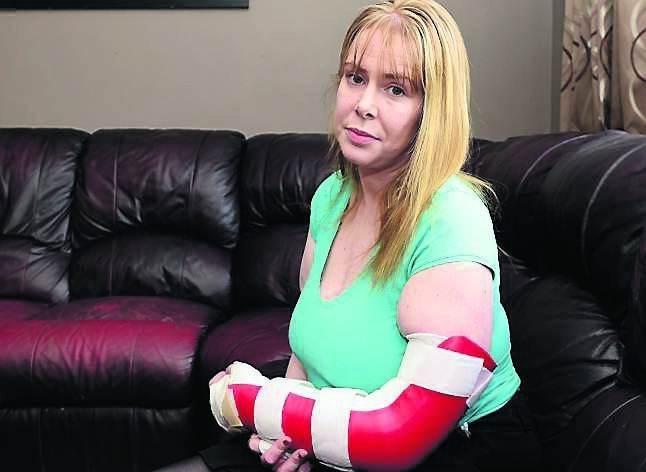 Pictured in 2015, Olivia Donnelly claims she was attacked by her late father's dog just days after his funeral. Her action for damages was settled today. Picture Ciara Wilkinson
