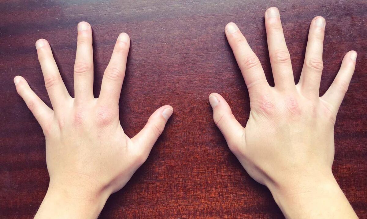 Cait Devane's Hurling Hands Cait Devane's Hurling Hands