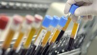 Israeli Laboratory Leads Western World In Blood Testing