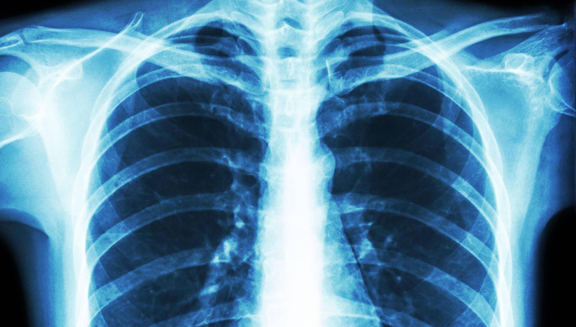 Radiographer struggled to take basic X-rays, inquiry told