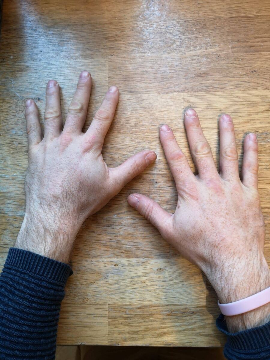 Ryan O'Dwyer's Hurling Hands