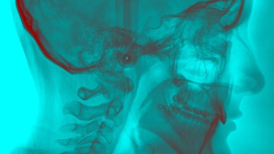 An X-ray image of a human face. 