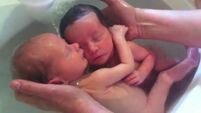 Awww of the day - the newborn twins that still think they're in the womb