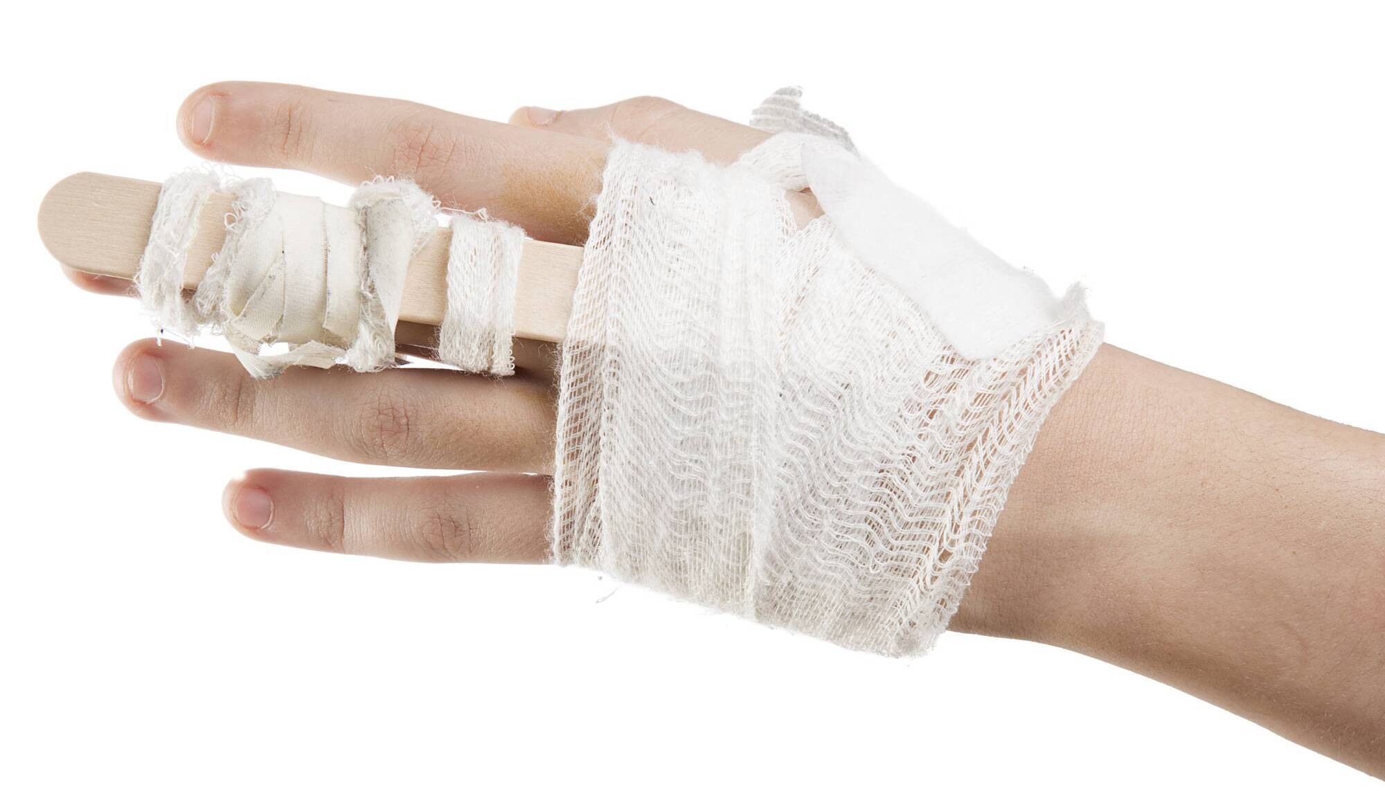 Girl settles for €75k over fingertip amputation after accident at church service