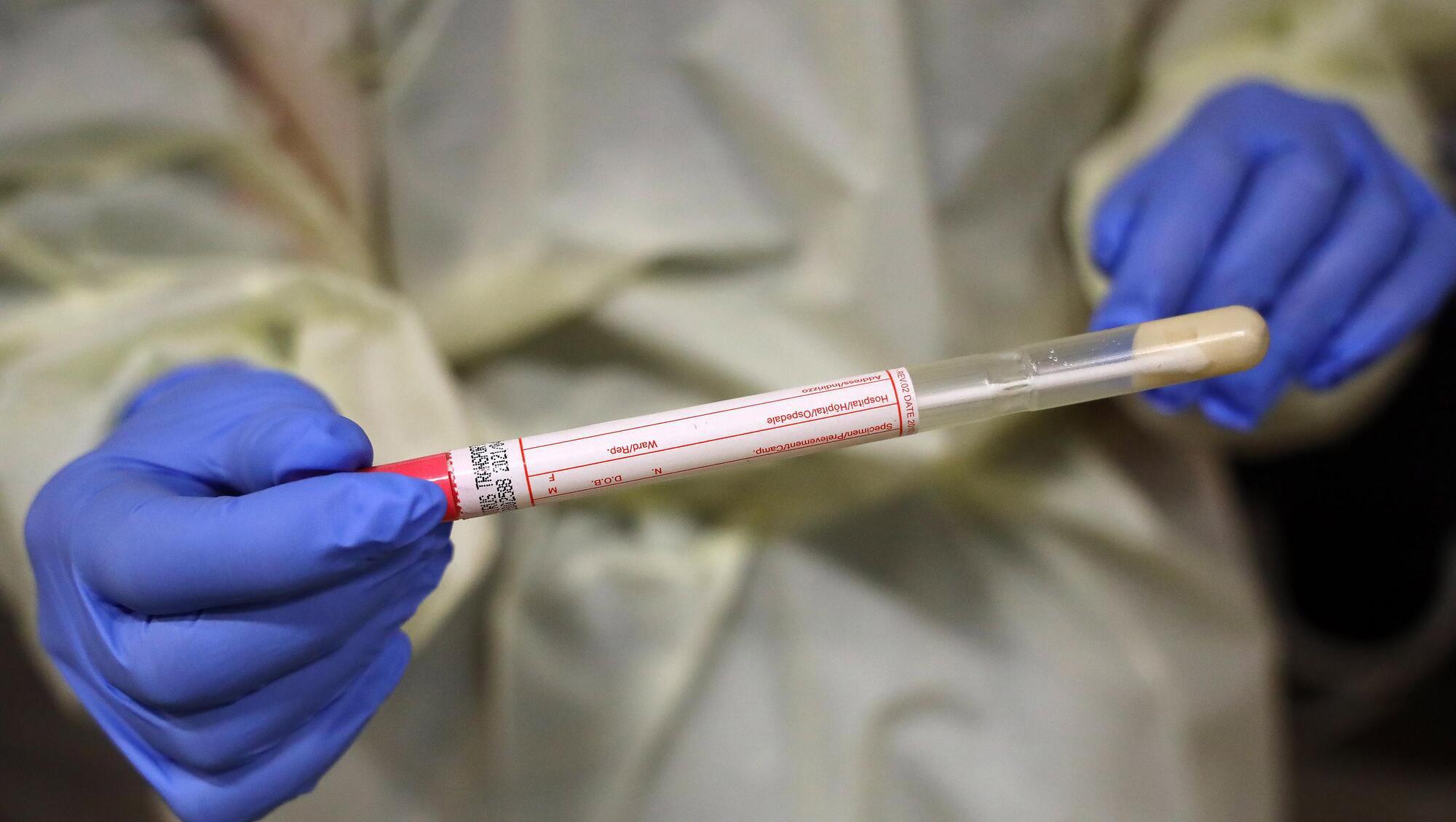A swab kit for testing Covid-19. Out of date staffing lists at nursing homes and meat factories may be distorting actual figures for those that have been tested. 	Picture: Marc O’Sullivan