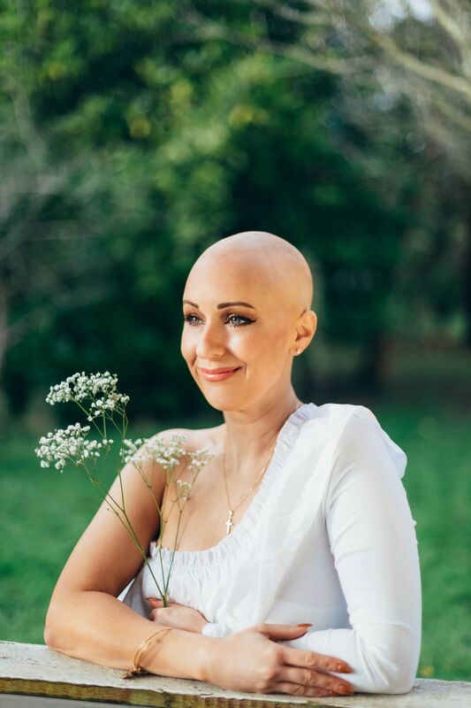 Alopecia affects around 0.1% to 0.2% of Ireland’s population Alopecia affects around 0.1% to 0.2% of Ireland’s population