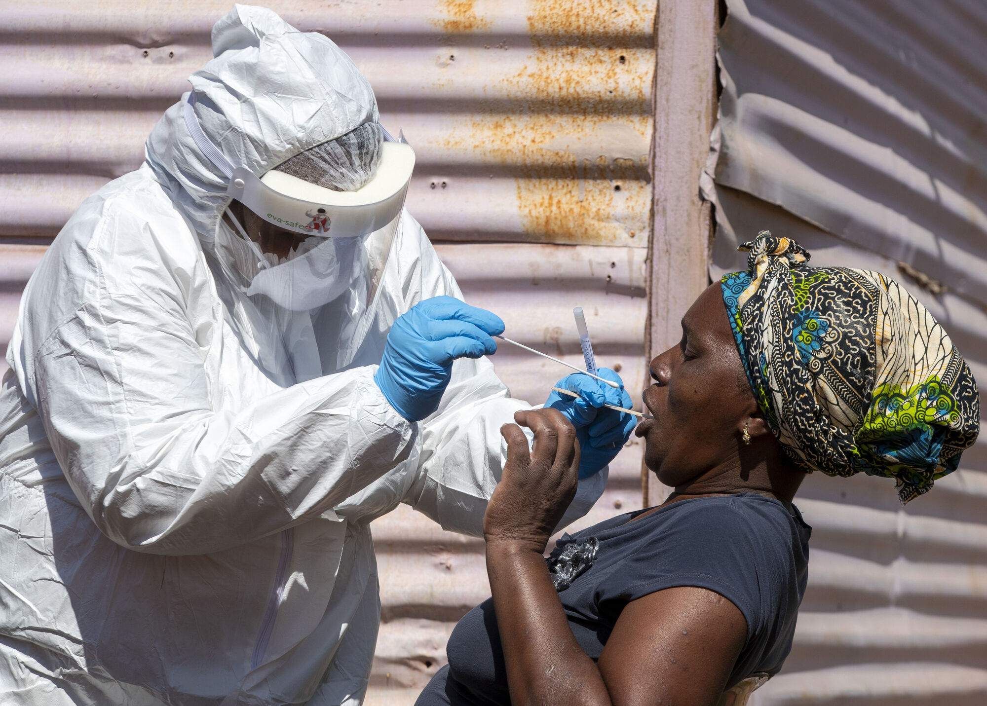 We cannot forget the millions without access to vaccines 