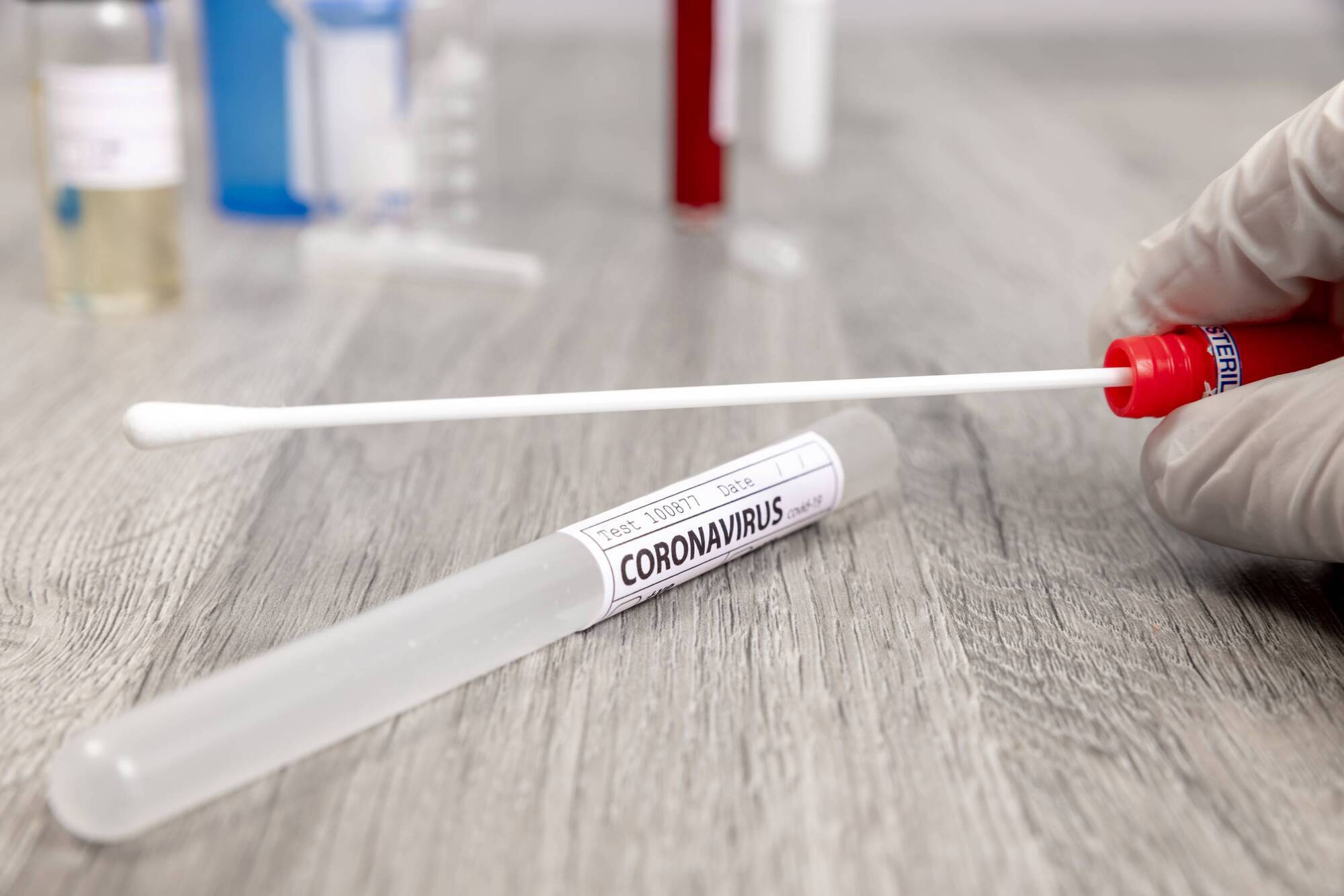 Saliva test a 'valid and accurate' alternative to nose/throat PCR swab, RCSI study finds