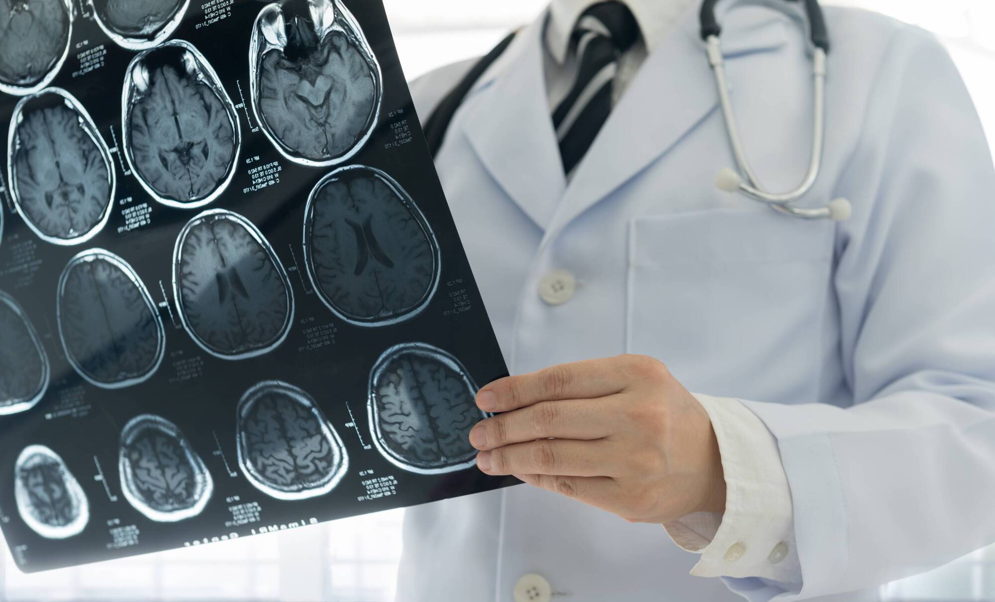 Researchers to examine whether incurable cancer can be treated with existing drug