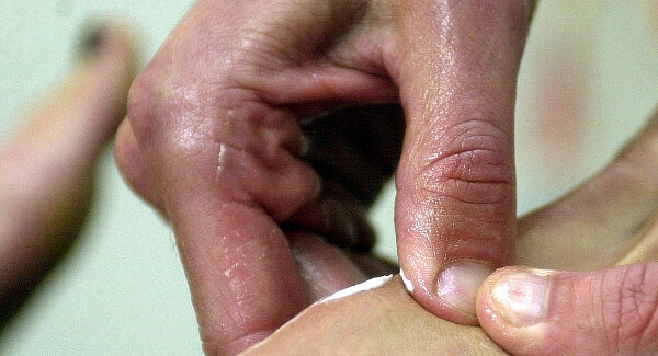 Physio 'bit client and growled', tribunal hears