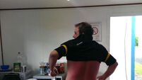 Is this Ireland's most sunburned man?
