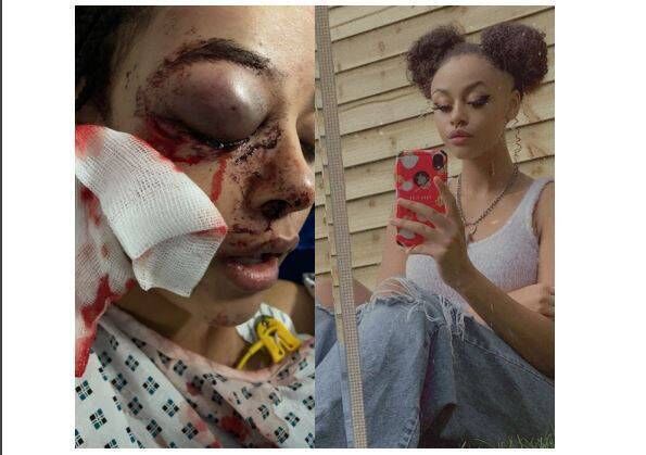 Alanna, who was assaulted on Thursday night. 