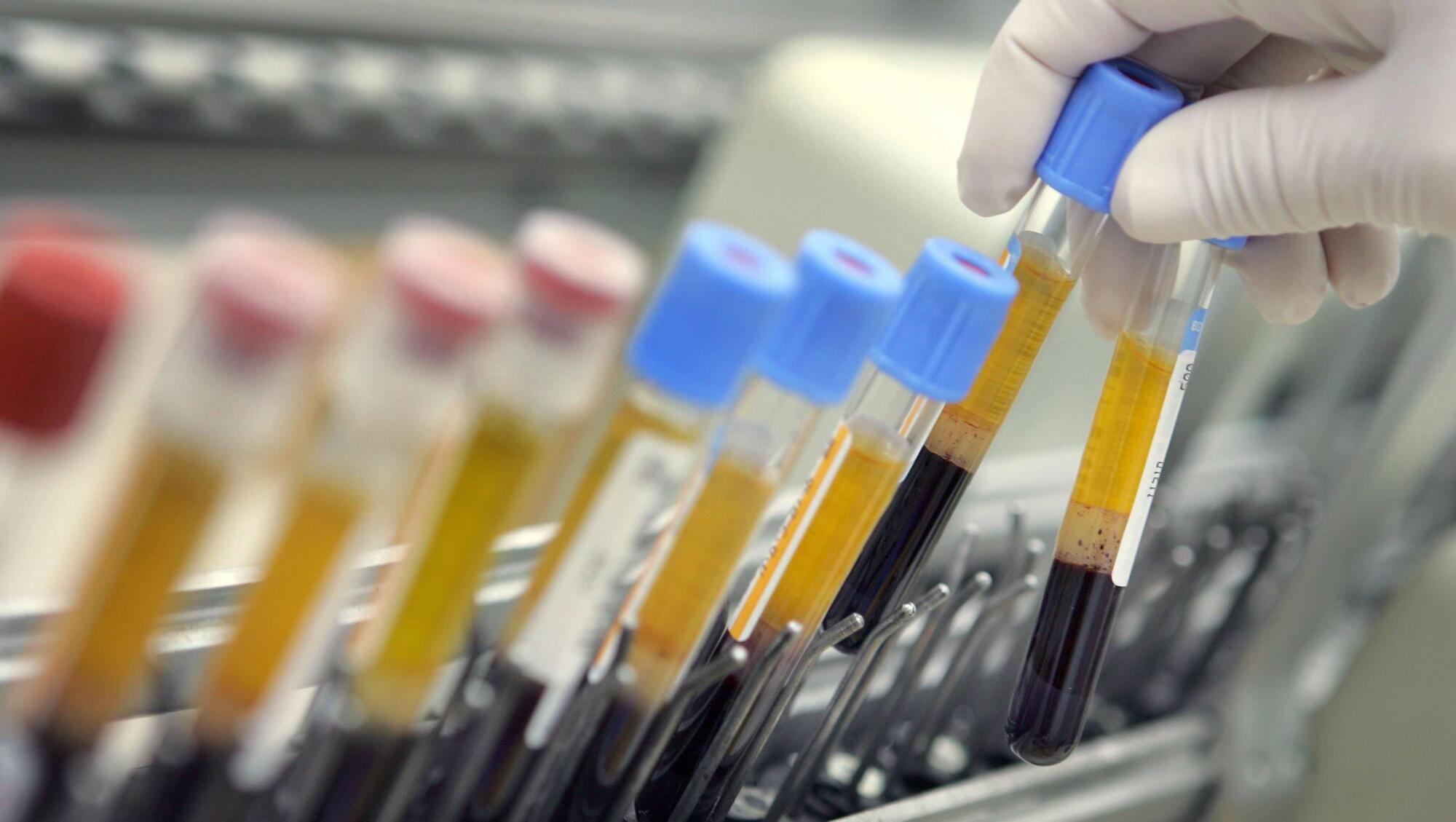 Over half of Europeans will be infected by Omicron in 6-8 weeks, according to WHO