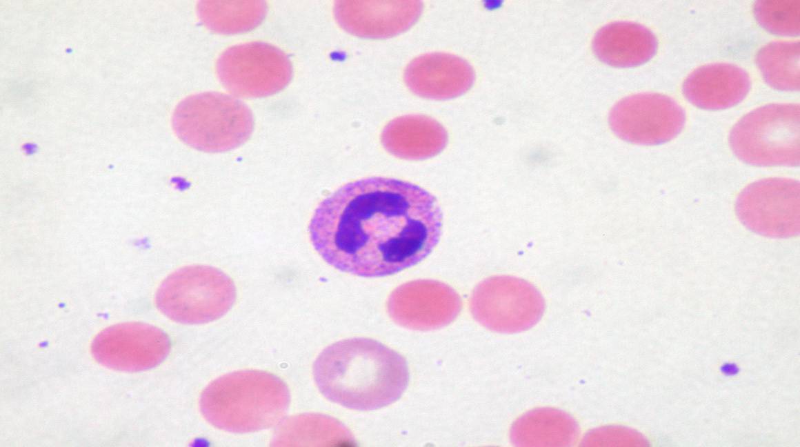 Cervical Check surpasses screening targets in 2021