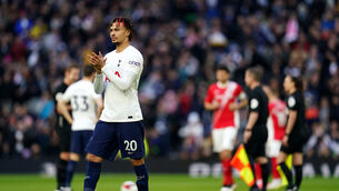 <p>Dele Alli joined the Toffees earlier this week in a deadline day move from Tottenham.</p>