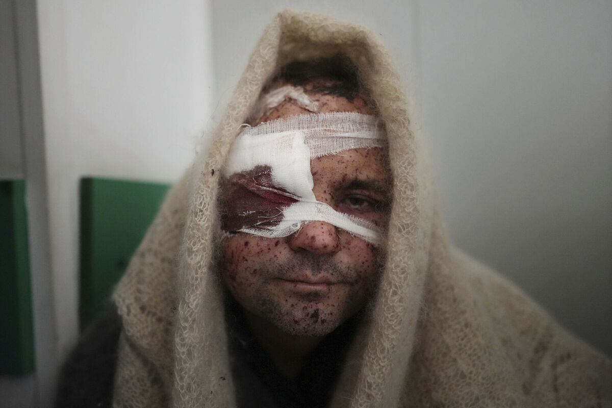 Serhiy Kralya, 41, looks at the camera after surgery at a hospital in Mariupol, eastern Ukraine on March 11, 2022. Kralya was injured during shelling by Russian forces. (AP Photo/Evgeniy Maloletka)