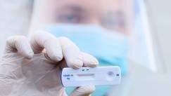 An antigen test. An antigen test.