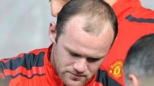 Rooney starts for United