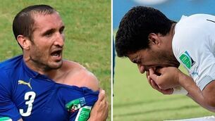 Uruguayan FA claims Suarez bite marks were photoshopped