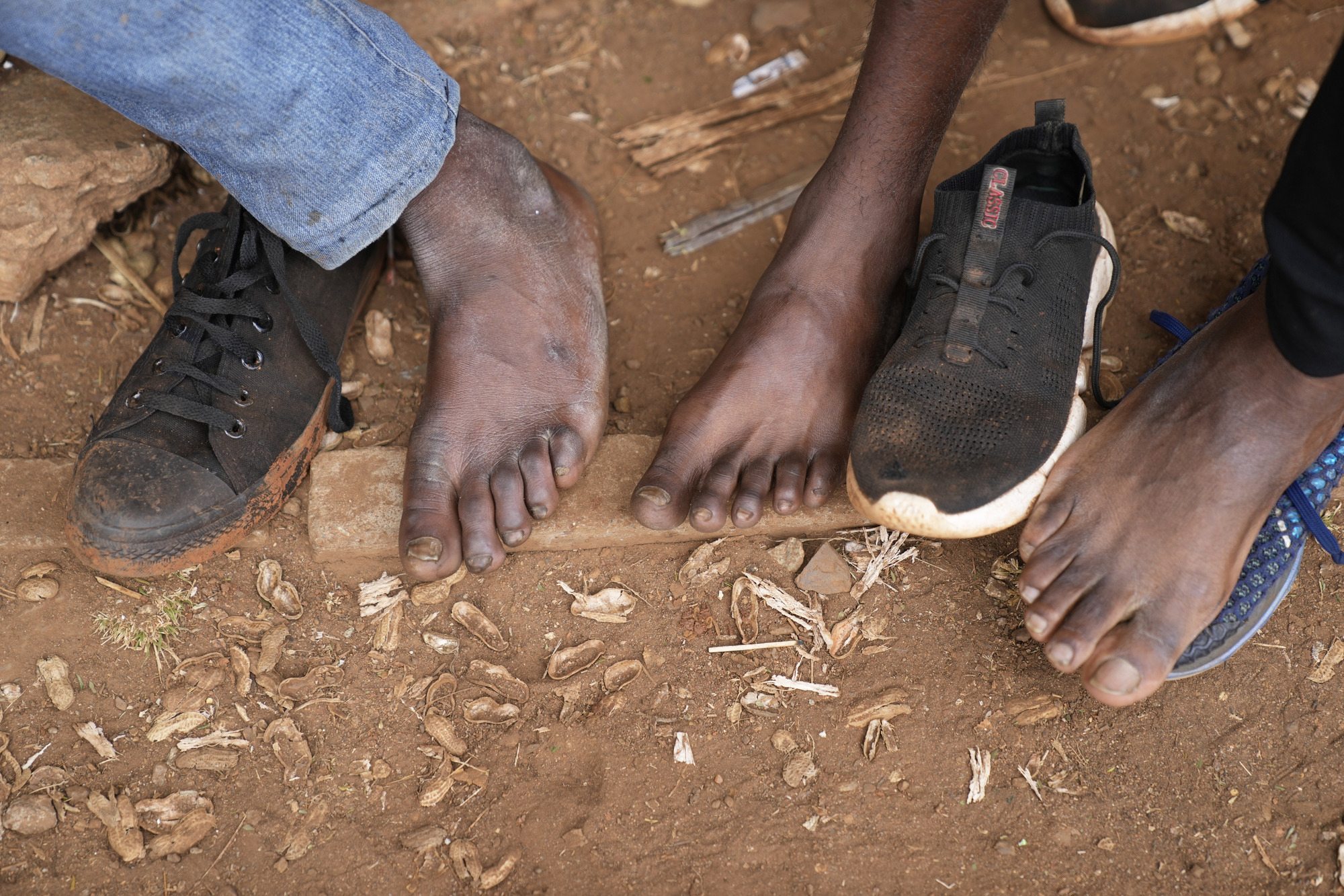 Toes-for-cash hoax reflects Zimbabwe fears of soaring prices