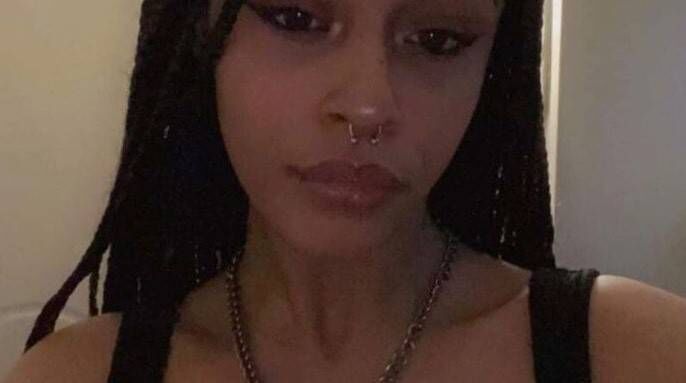 Alanna Quinn Idris, now 18, underwent several operations to fix her eye socket and lost her sight in the injured eye