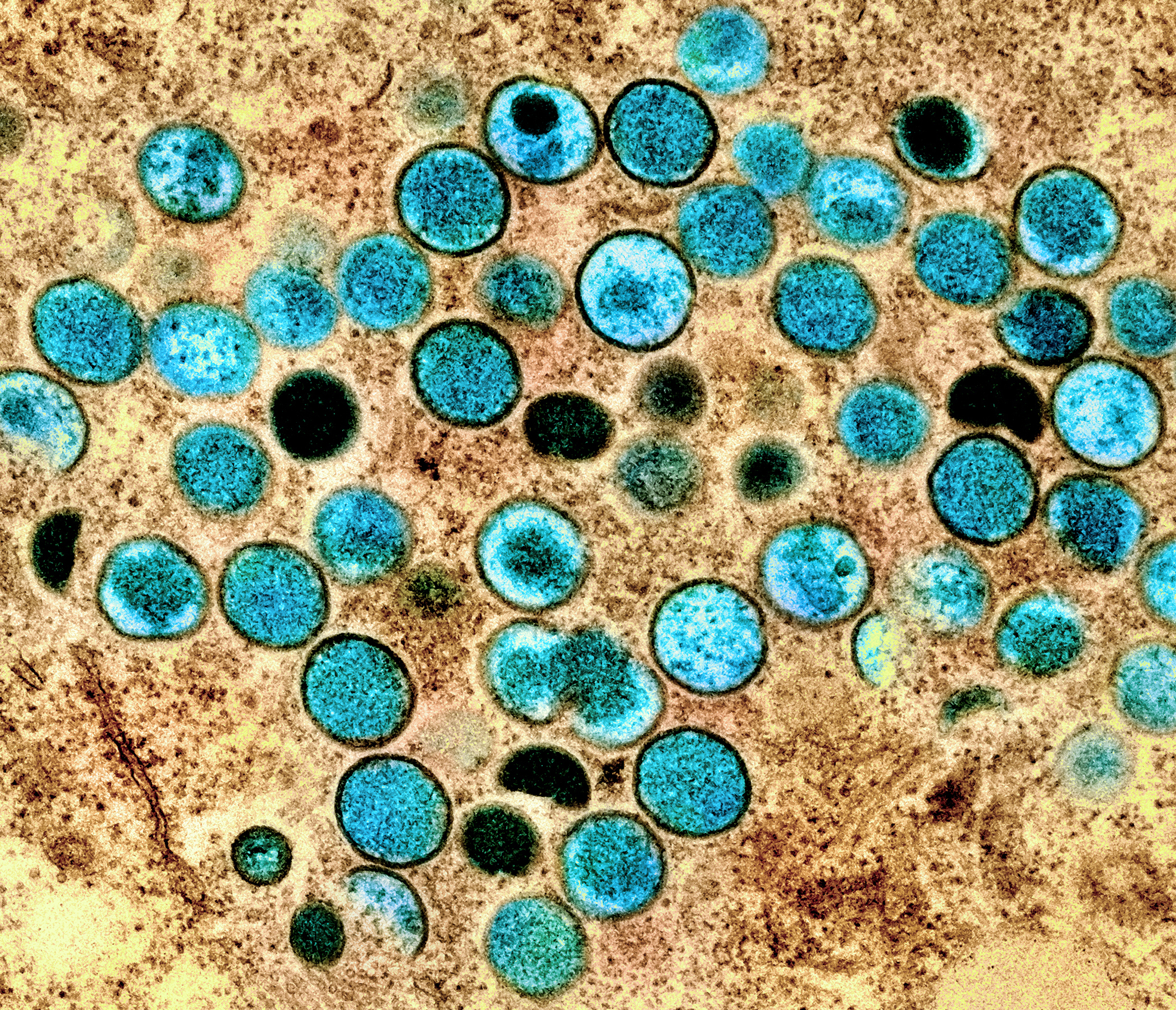 HSE to issue vaccination advice for groups most at risk of monkeypox soon