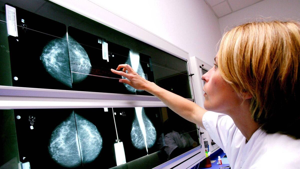 'Magic bullet' drug now available on clinical trial to breast cancer patients in Ireland - Vimarsana News
