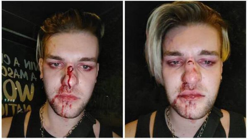 'I haven't really slept since': Calls for action after suspected homophobic bus attack 'I haven't really slept since': Calls for action after suspected homophobic bus attack
