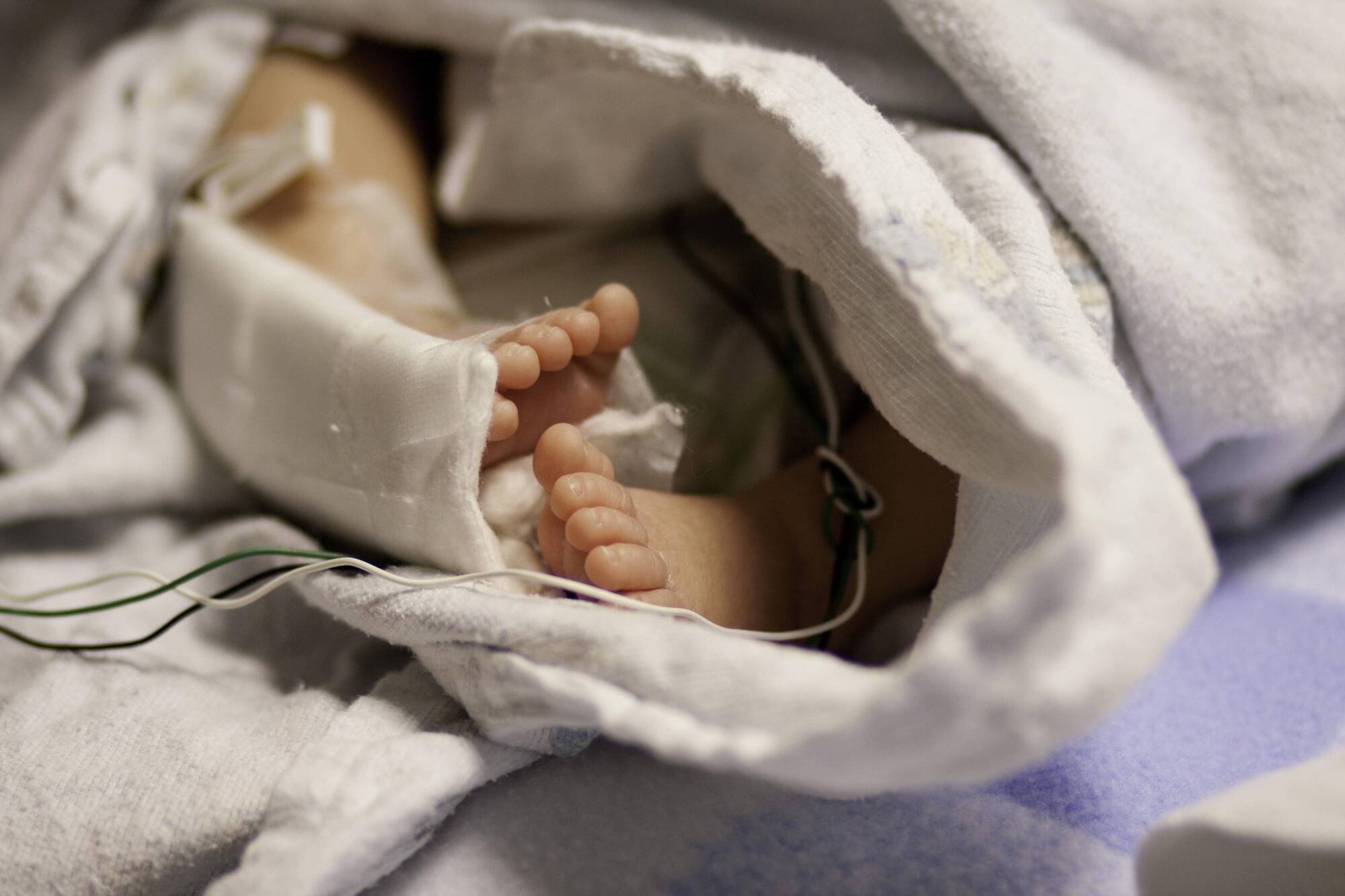 Stillbirth/infant death rates up to two times higher among African mothers giving birth here