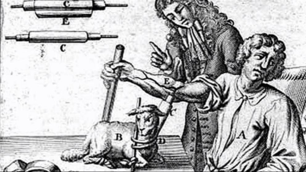 The first documented blood transfusion. On 15 June 1667, the French doctor Jean-Baptiste Denys, personal physician to King Louis XIV, gave sheep's blood to a fifteen year-old boy. Miraculously he survived (history.info) 